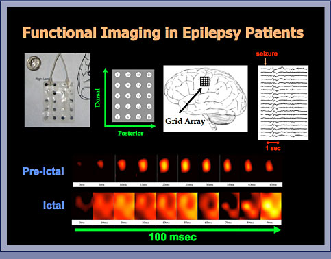 Electrode Array Imaging Slide 5