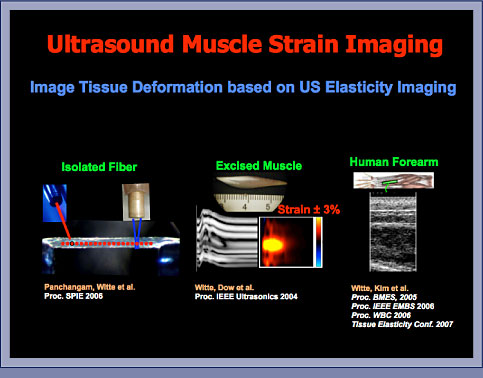 Muscle Strain Imaging: Slide 1