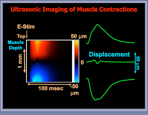Muscle Strain Imaging: Slide 2