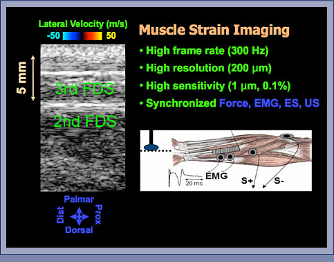 Muscle Strain Imaging: Slide 3