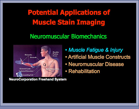 Muscle Strain Imaging: Slide 6
