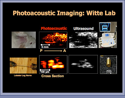 Photoacoustic Imaging: Slide 2