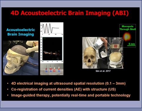 Ultrasound Current Source Density Imaging: Slide 4