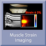 Muscle Stran Imaging