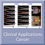 Clinical Applications Cancer
